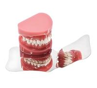 Miroir dentaire en acier inoxydable, réflecteur buccal pour usage orthodontique, outil d'examen dentaire professionnel(A)