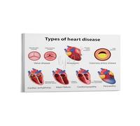 SSOPTMCB Educational Heart Health Poster Cardiovascular System Wellness Guide Awareness Chart for Home Office Classroom Decor(Framed,12x18inch(30x45cm))