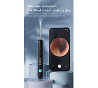 Verbex SL11 Nettoyeur d’oreilles avec otoscope compatible WiFi, iPhone, iPad et Android - Noir